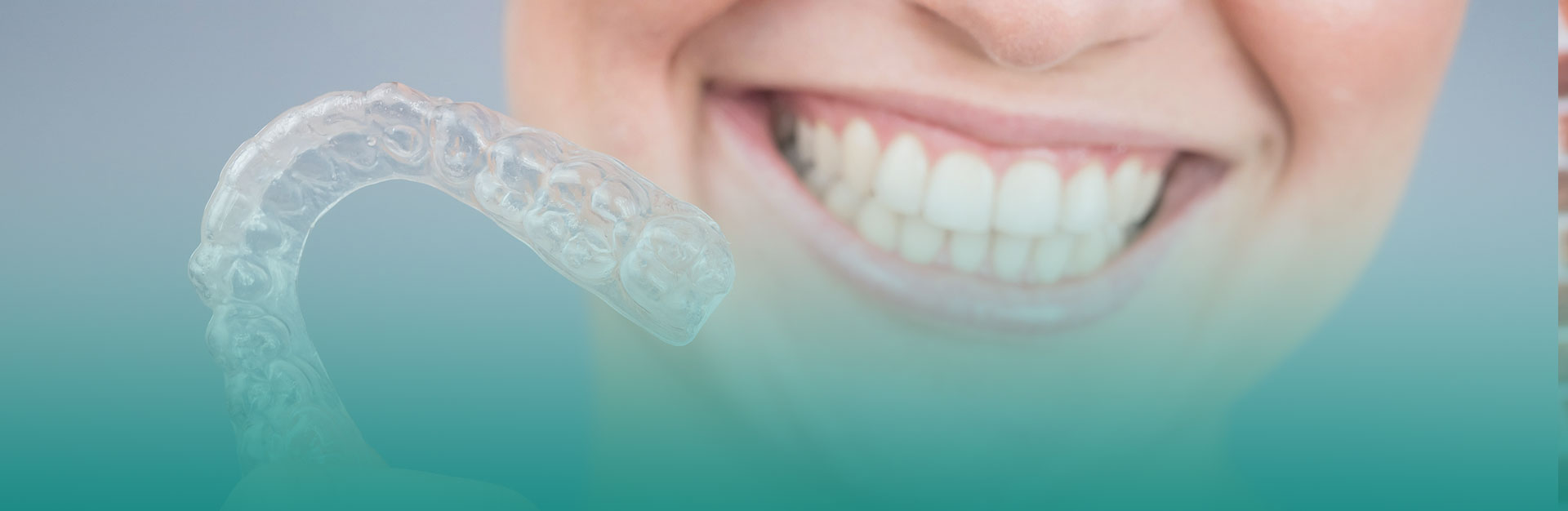 A woman is holding a Invisalign braces